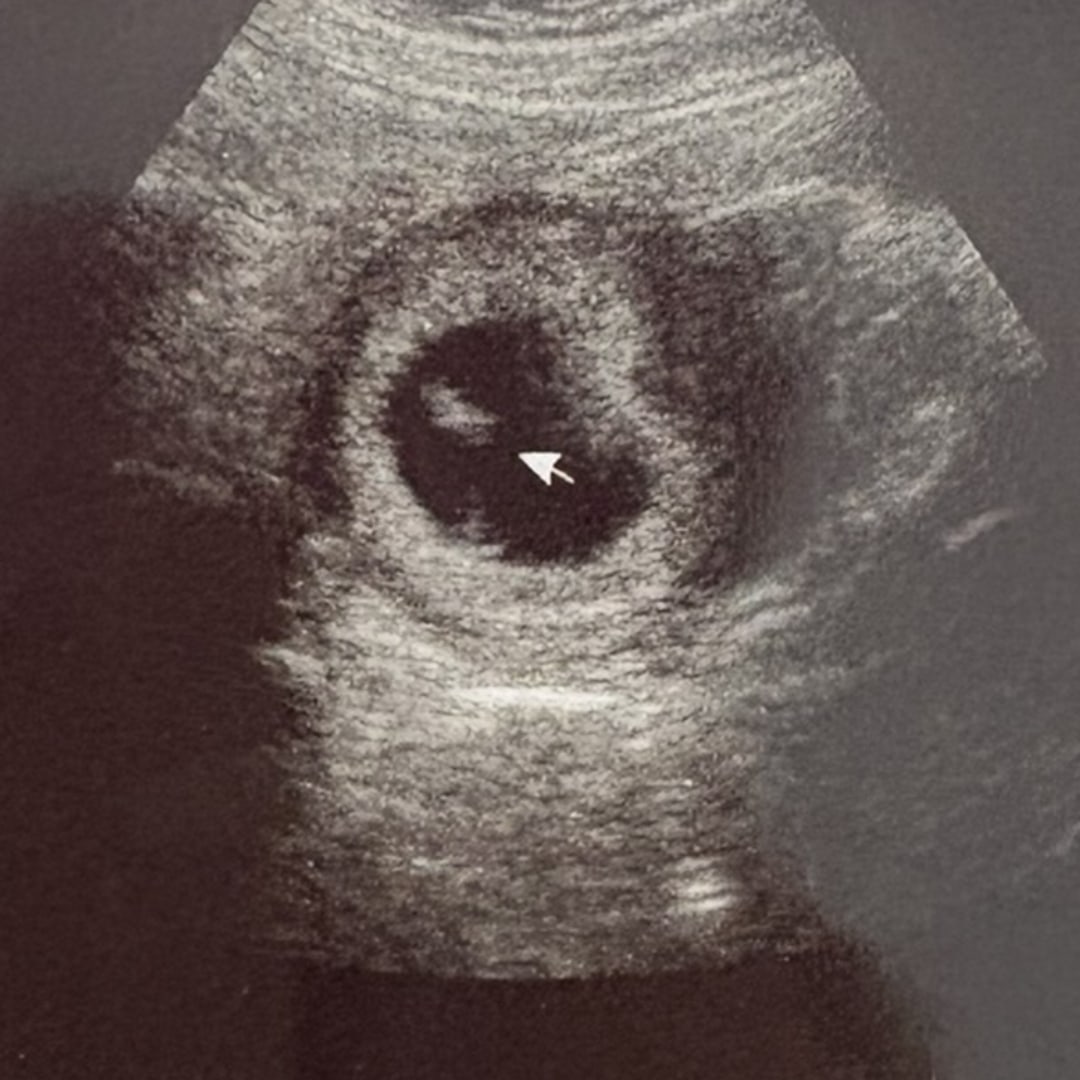 Photo shared by Nayeli for their Babylist baby registry.