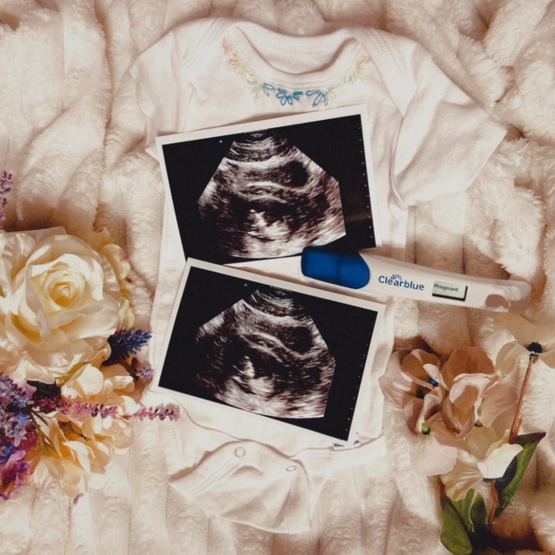 Photo shared by Madison for their Babylist baby registry.