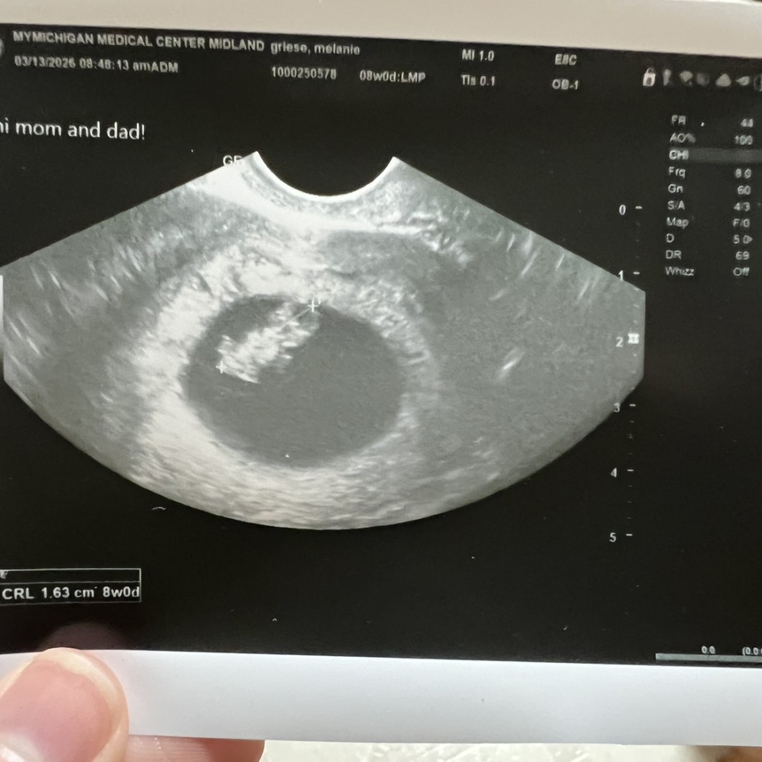 Photo shared by Mel for their Babylist baby registry.