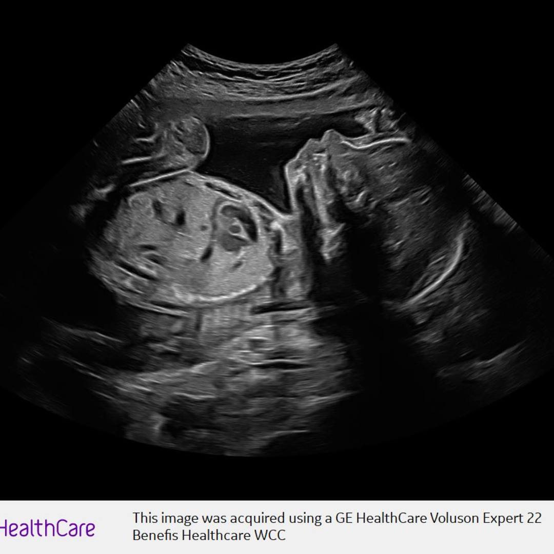 Photo shared by Haven for their Babylist baby registry.