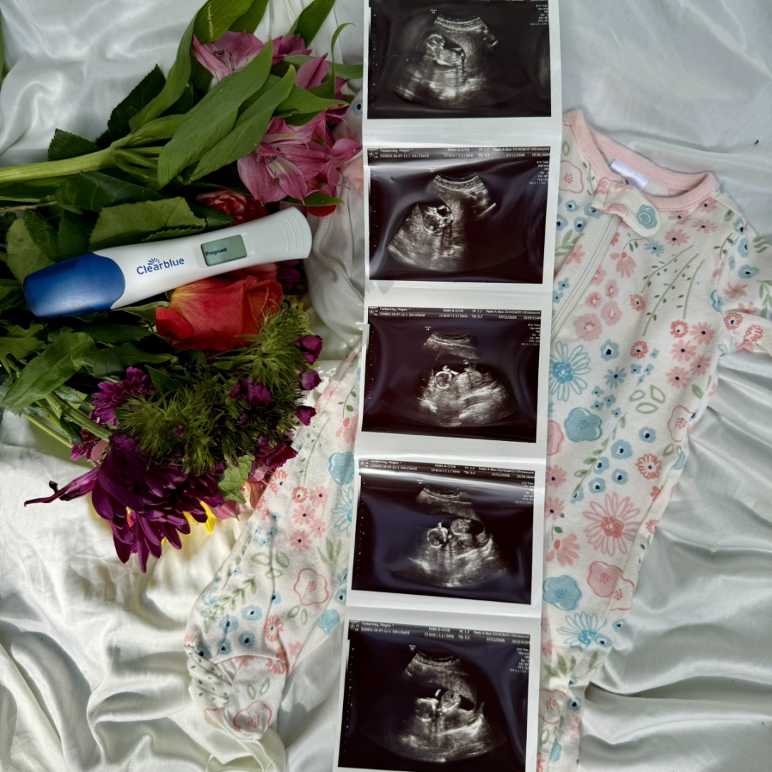 Photo shared by Megan for their Babylist baby registry.