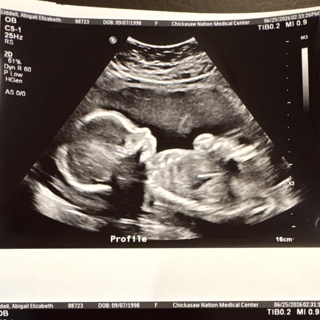 Photo shared by Abigail for their Babylist baby registry.