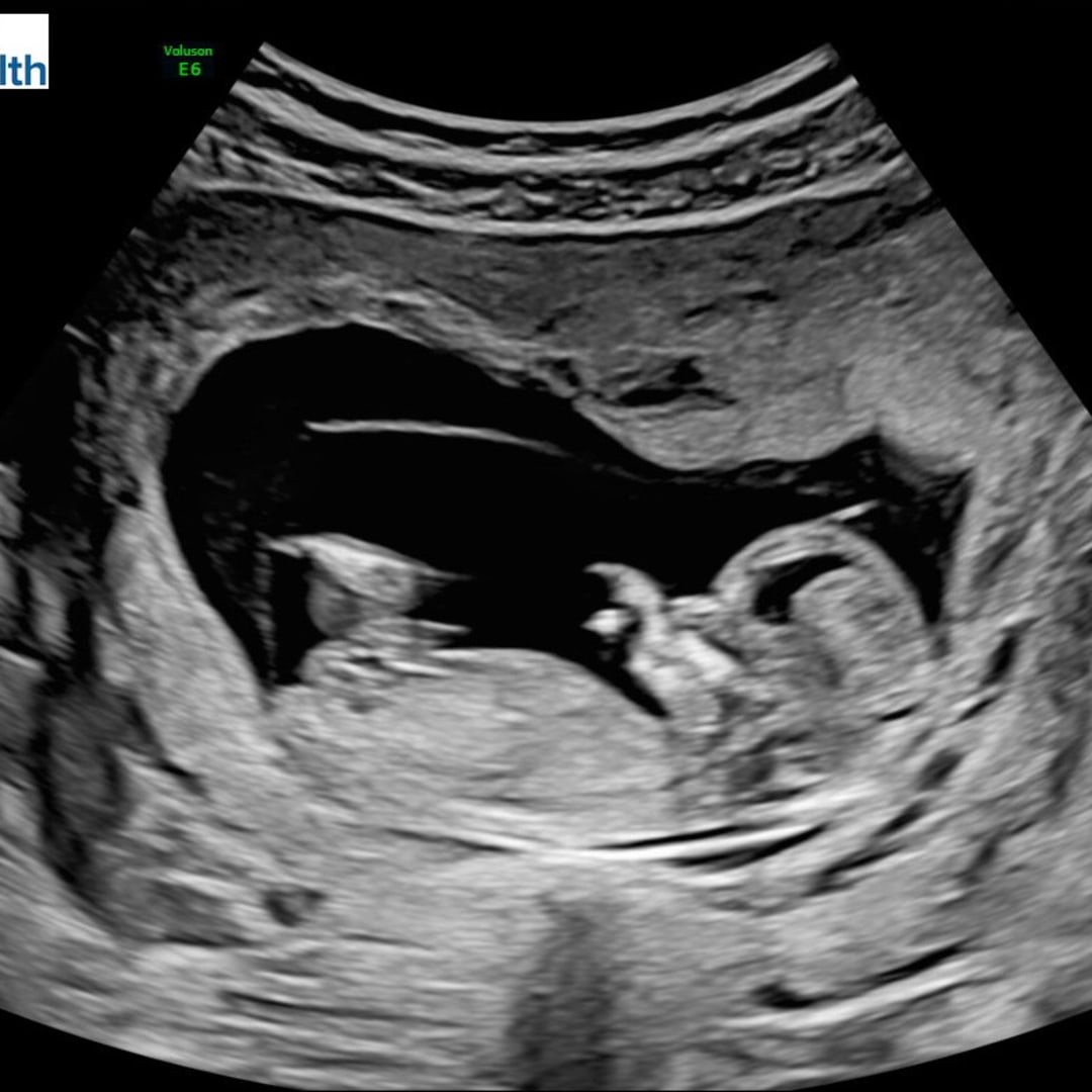 Photo shared by Lena for their Babylist baby registry.