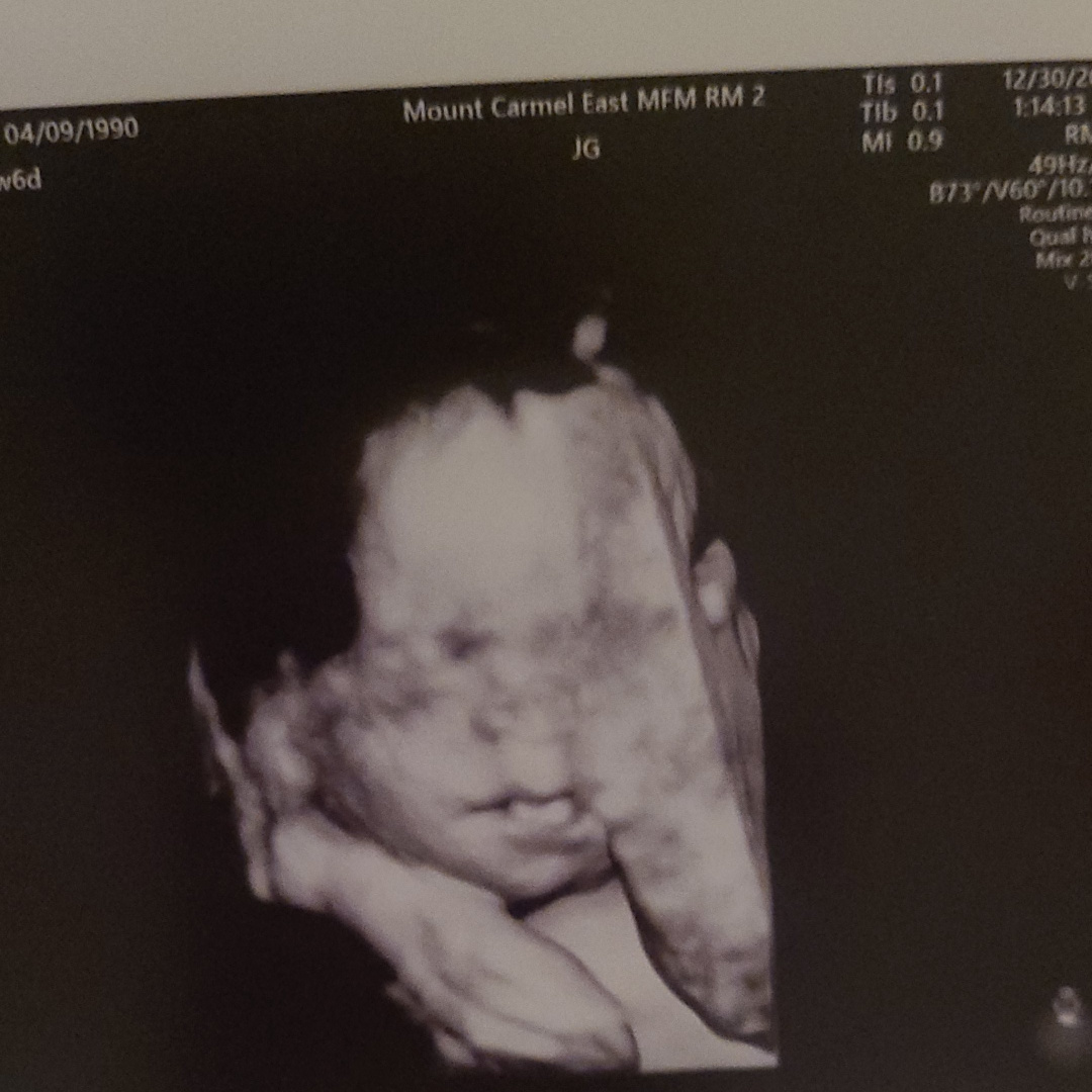 Photo shared by Kayla for their Babylist baby registry.