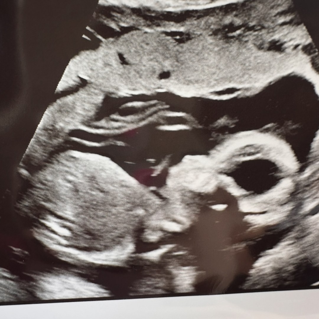 Photo shared by Adrienne for their Babylist baby registry.