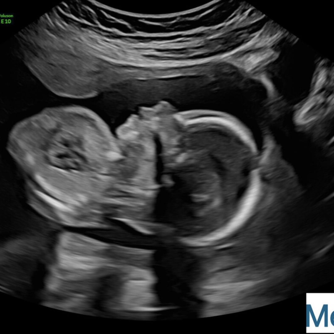 Photo shared by Jacob for their Babylist baby registry.