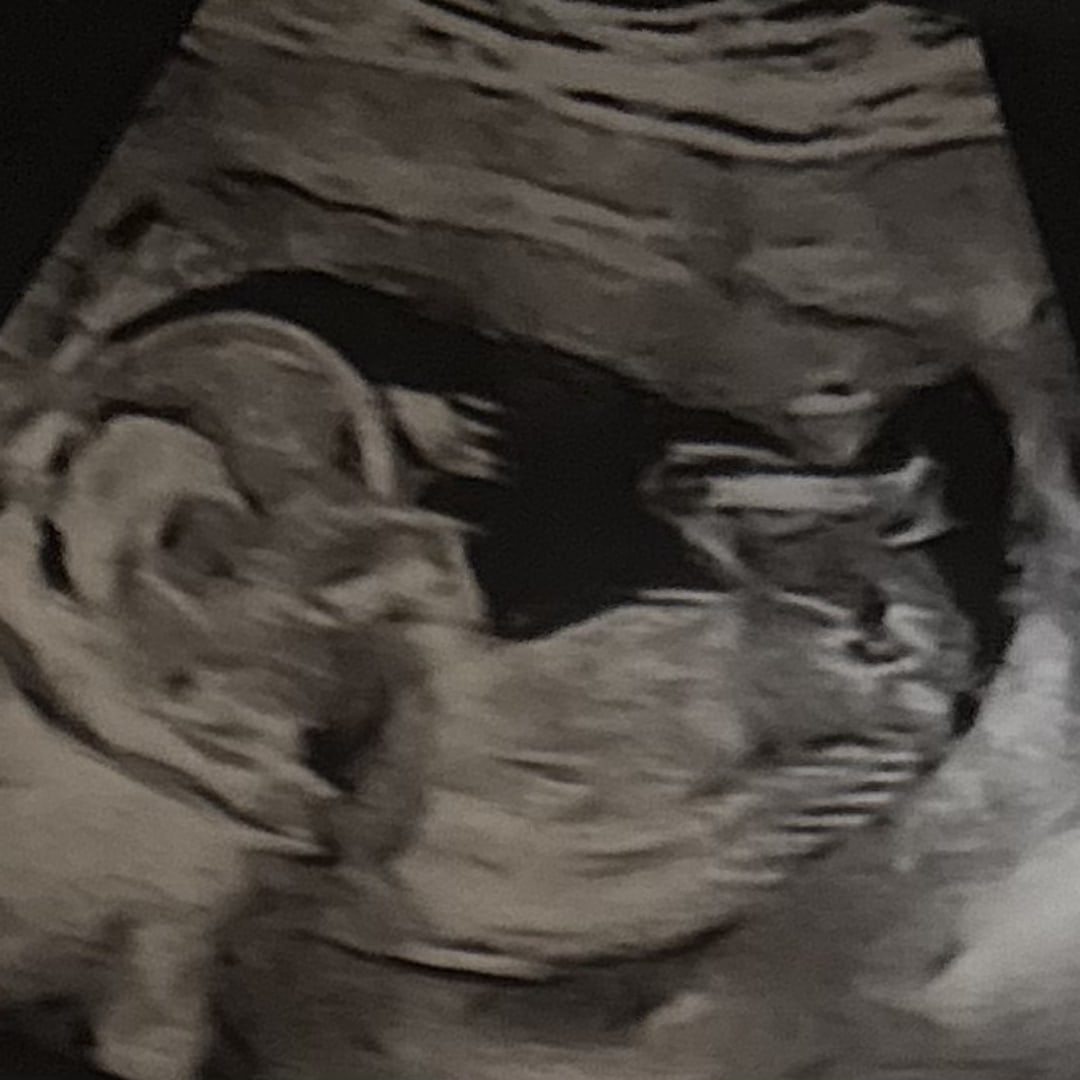Photo shared by Michelle for their Babylist baby registry.