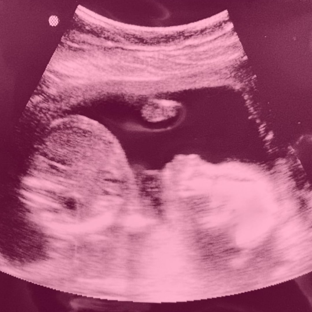 Photo shared by Gabriella for their Babylist baby registry.