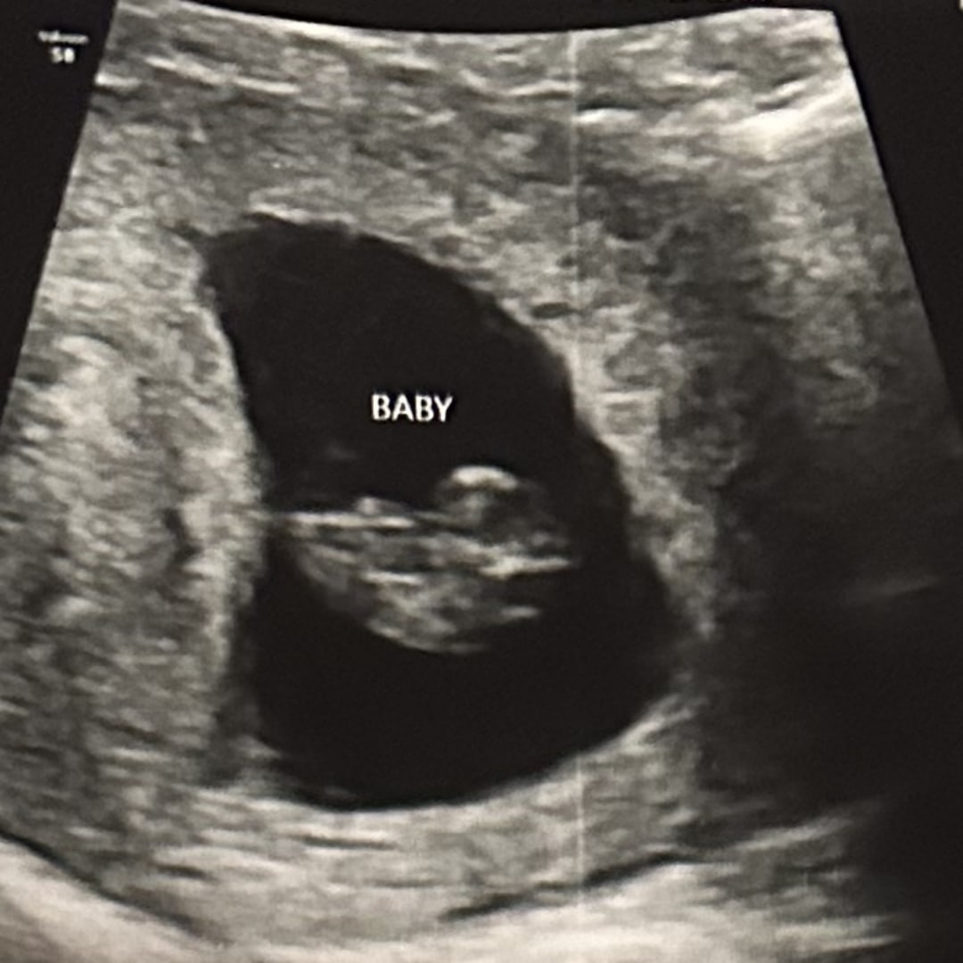 Photo shared by Kelsey for their Babylist baby registry.