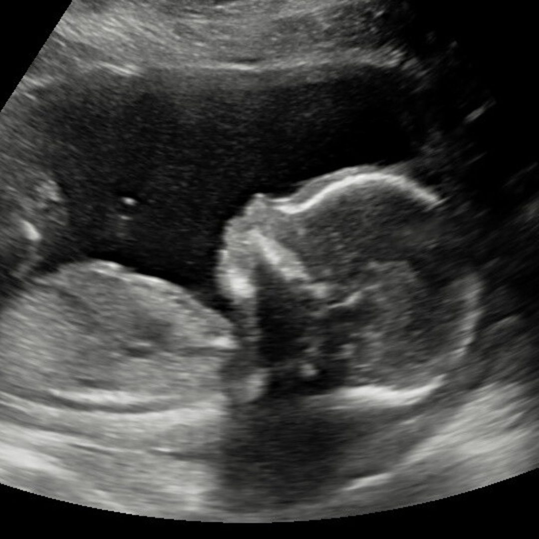 Photo shared by Alisha for their Babylist baby registry.