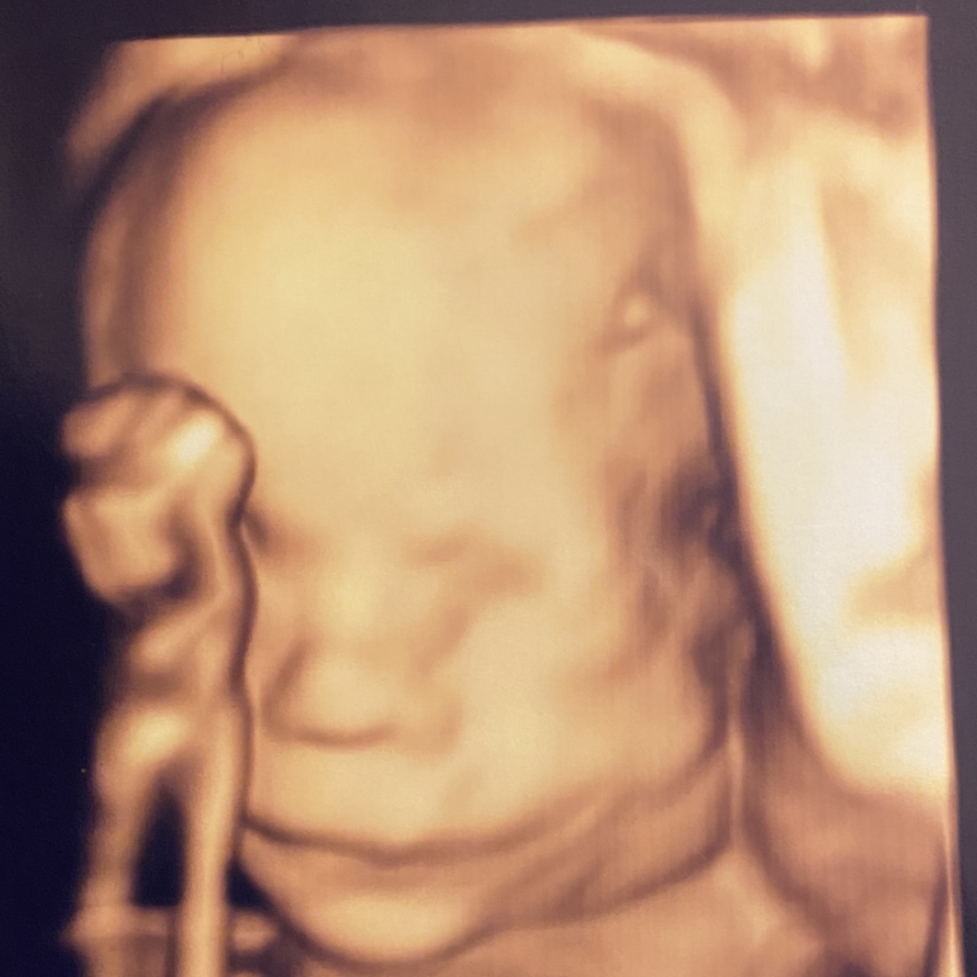 Photo shared by Laura for their Babylist baby registry.