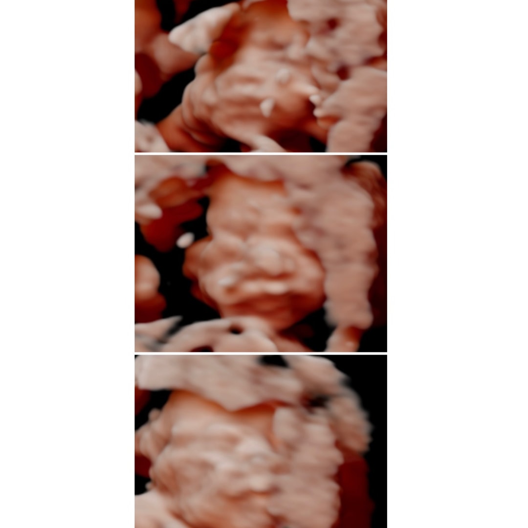 Photo shared by Emmy for their Babylist baby registry.