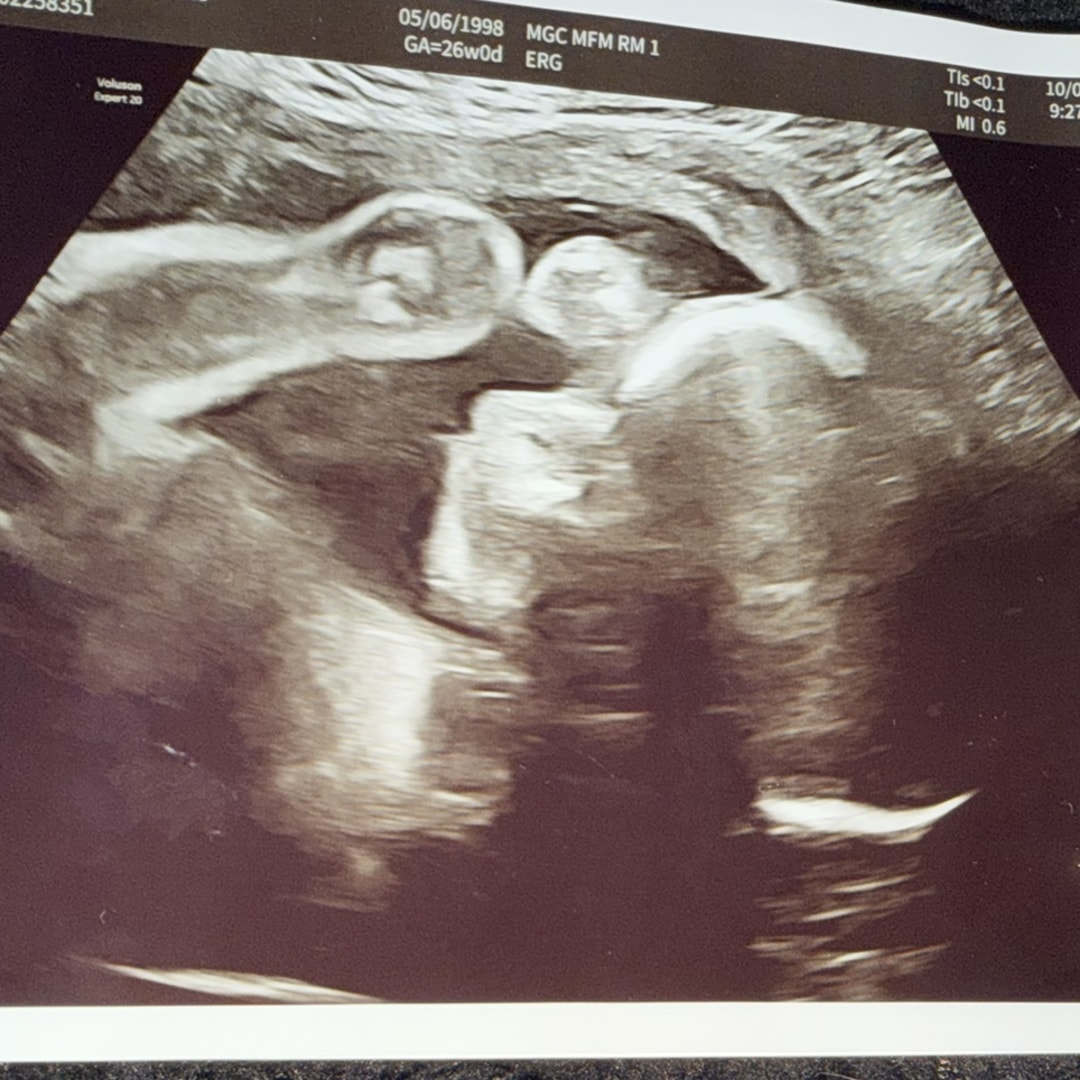 Photo shared by Melody for their Babylist baby registry.