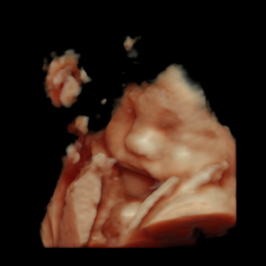 Photo shared by Chantal for their Babylist baby registry.