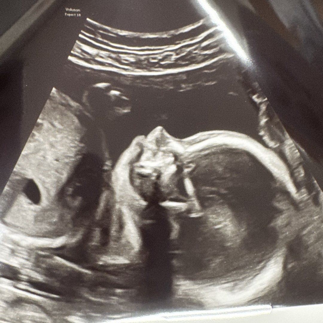 Photo shared by Erynn for their Babylist baby registry.