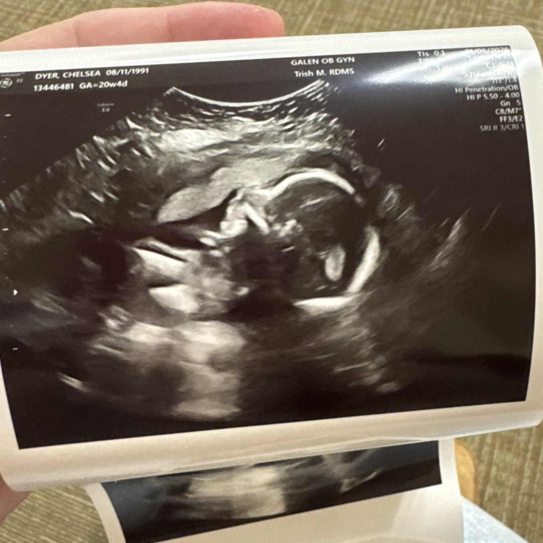 Photo shared by Chelsea for their Babylist baby registry.