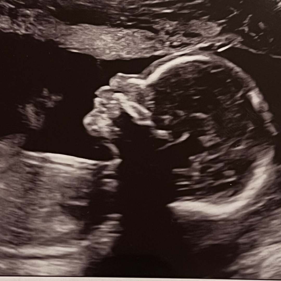 Photo shared by Katrina for their Babylist baby registry.