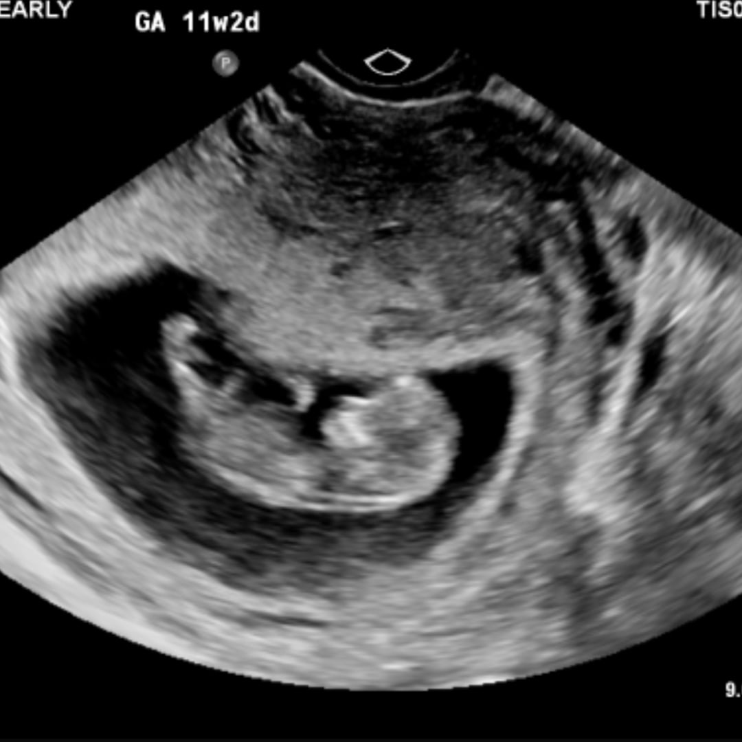 Photo shared by Dallas for their Babylist baby registry.