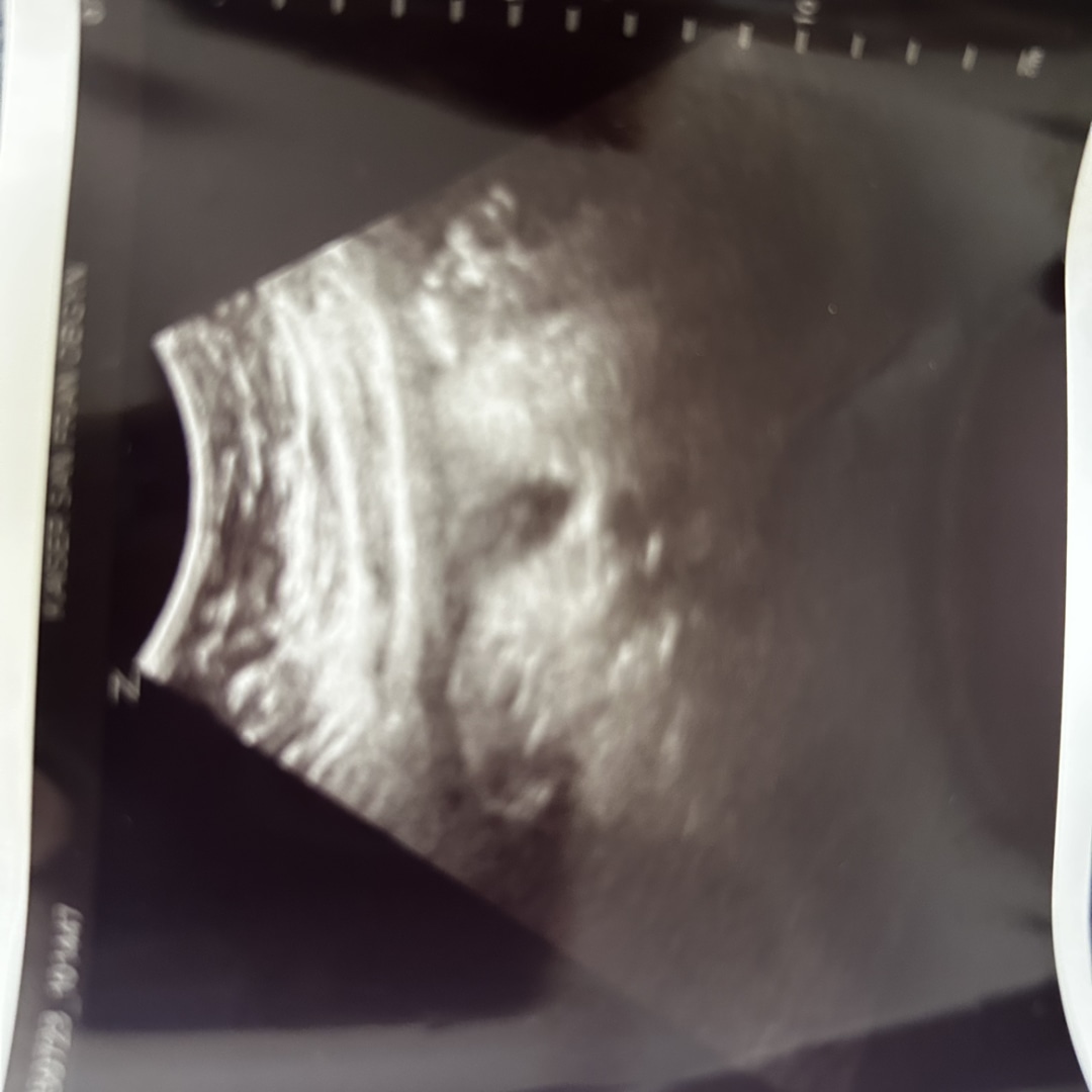Photo shared by Brittney for their Babylist baby registry.