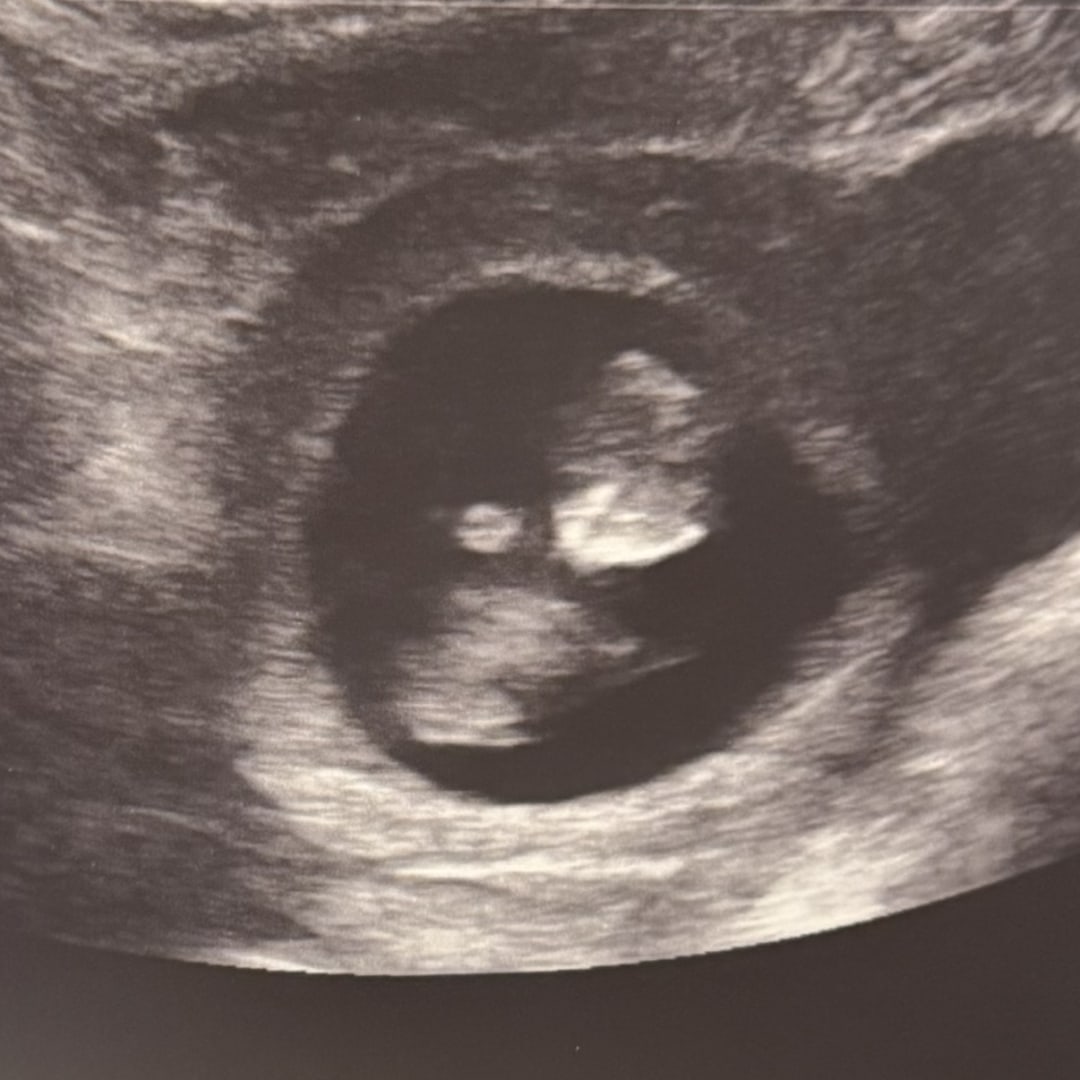 Photo shared by Jordan for their Babylist baby registry.