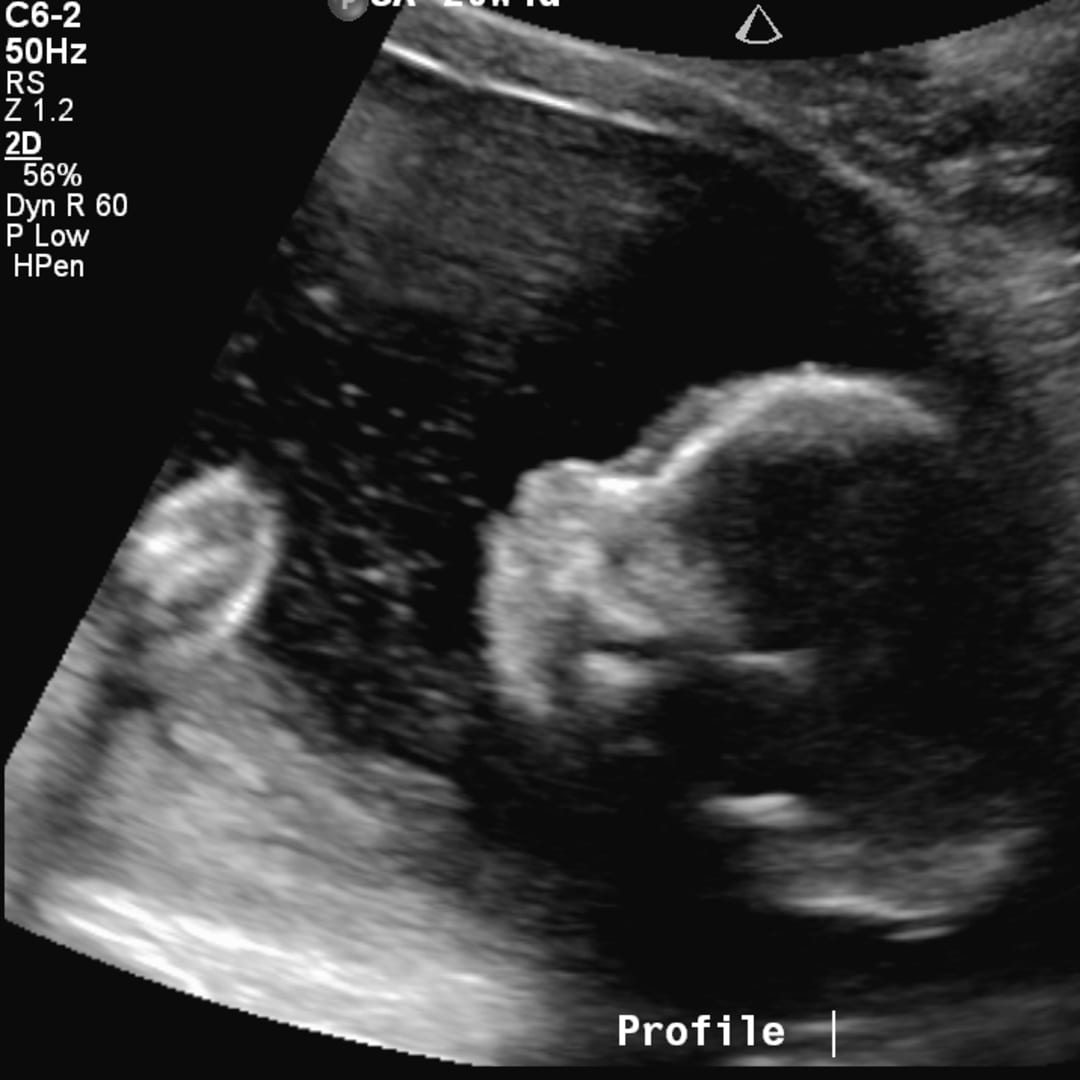 Photo shared by Jessica for their Babylist baby registry.