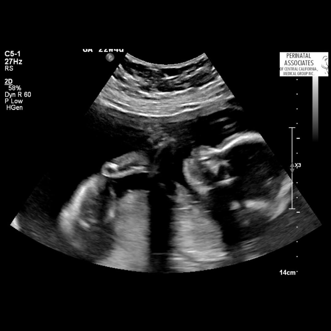 Photo shared by Jessie for their Babylist baby registry.