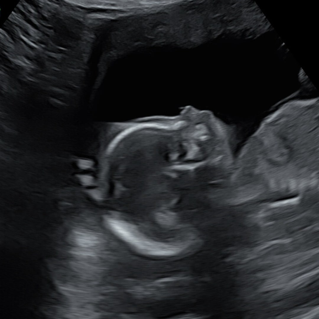 Photo shared by Hannah for their Babylist baby registry.