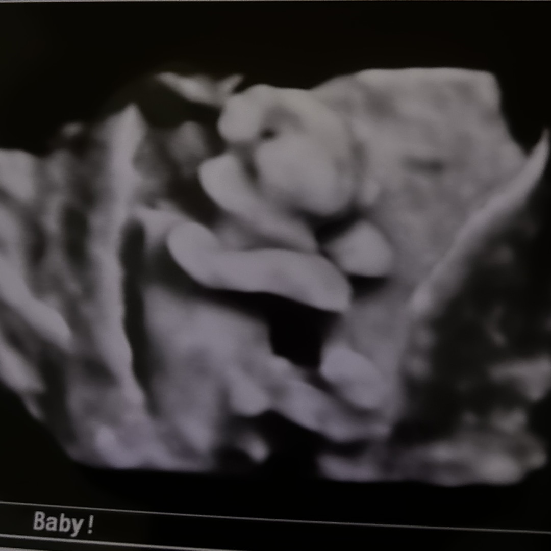 Photo shared by Raquel for their Babylist baby registry.