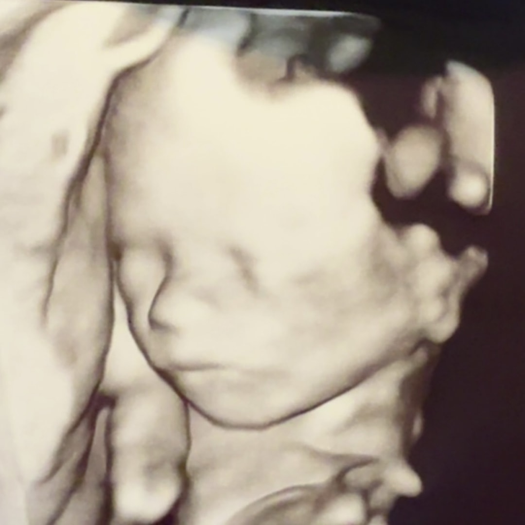 Photo shared by Bindi for their Babylist baby registry.