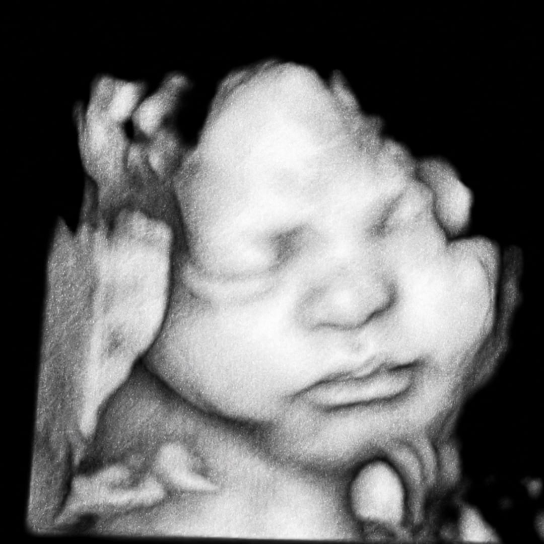 Photo shared by Mira for their Babylist baby registry.