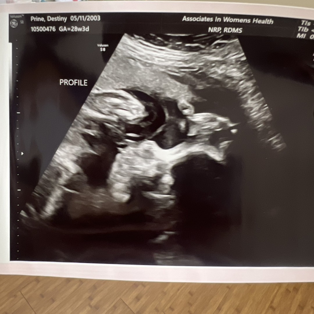 Photo shared by Destiny for their Babylist baby registry.