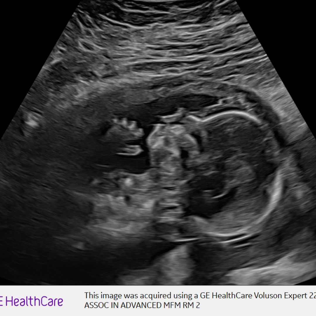 Photo shared by Jany for their Babylist baby registry.