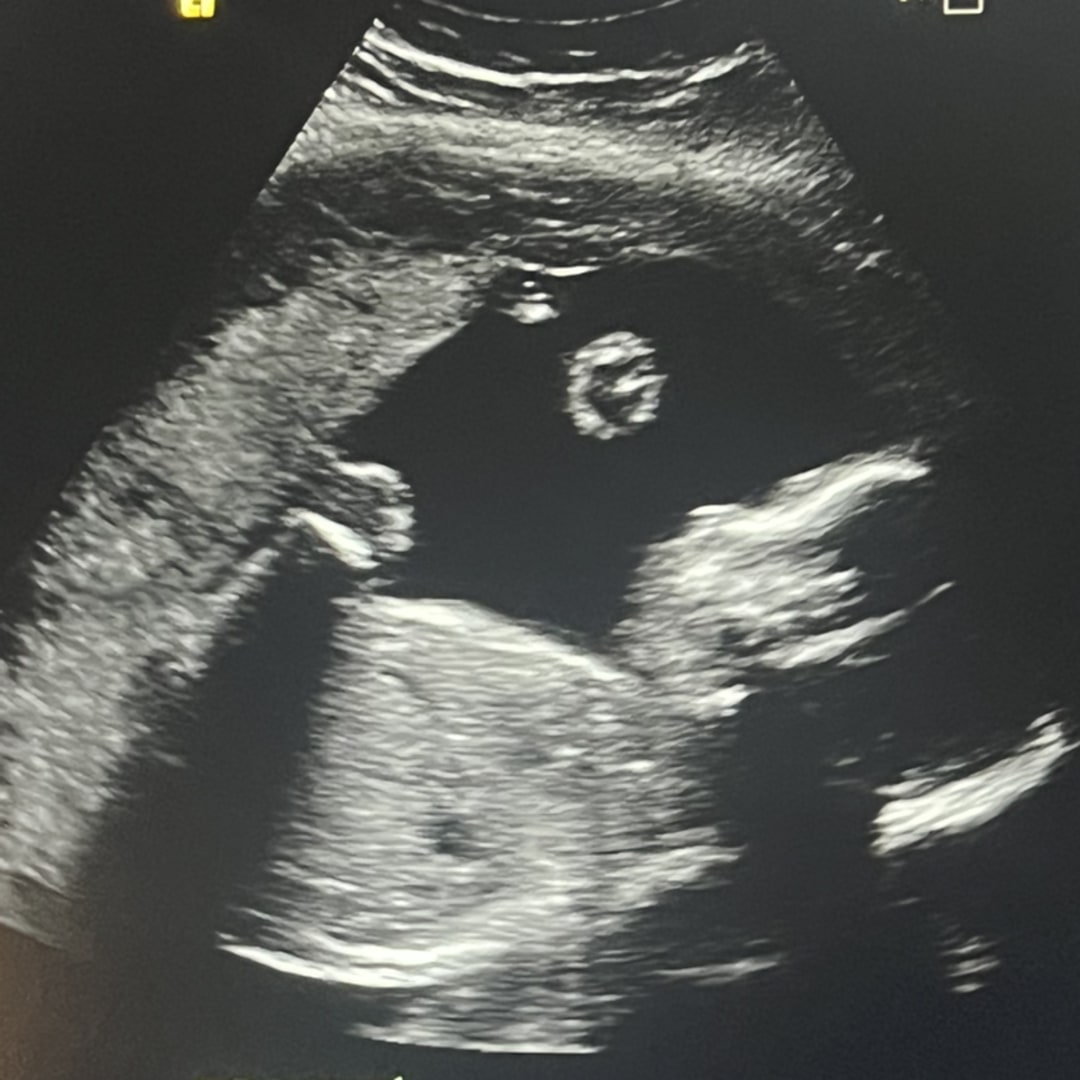Photo shared by Tiffany for their Babylist baby registry.