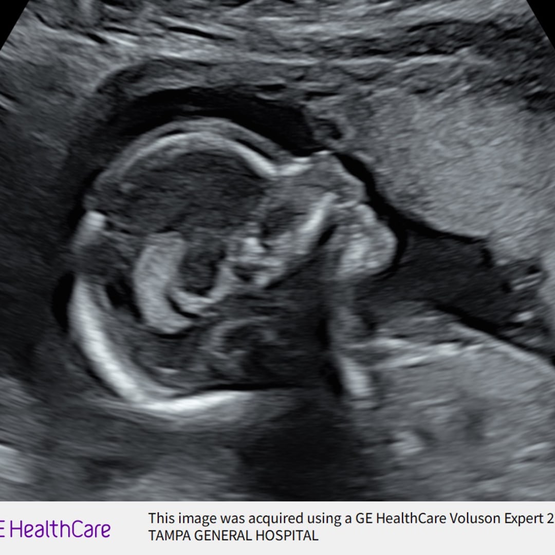 Photo shared by Camilla for their Babylist baby registry.