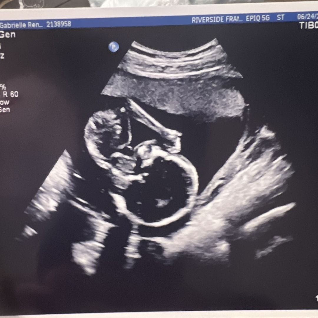 Photo shared by Gabrielle for their Babylist baby registry.
