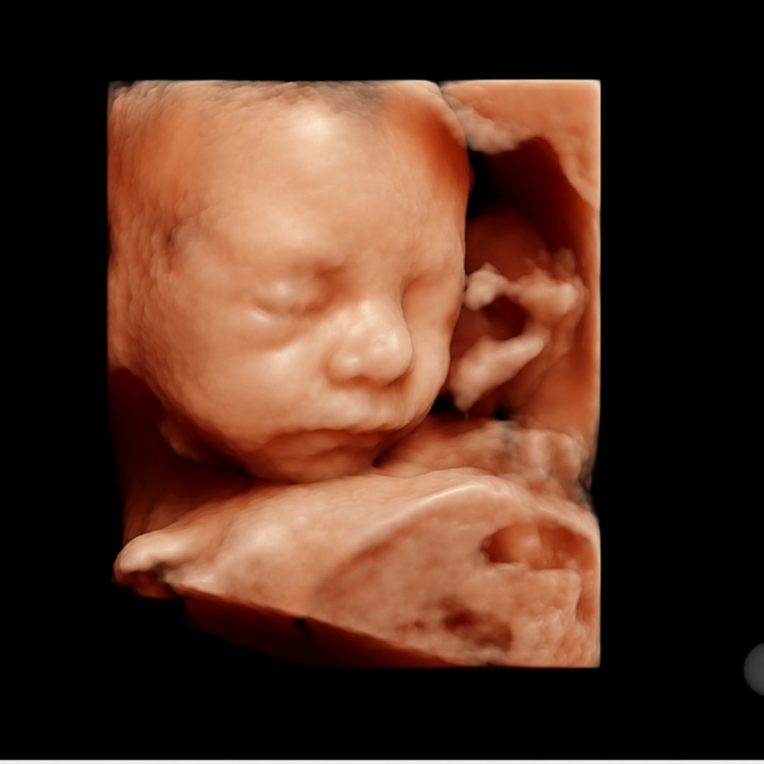 Photo shared by Hattie for their Babylist baby registry.