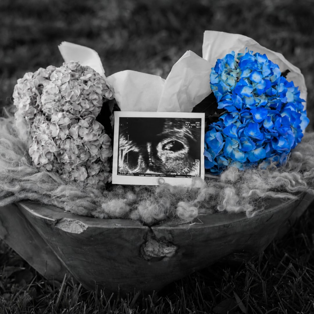 Photo shared by Mackenzie for their Babylist baby registry.
