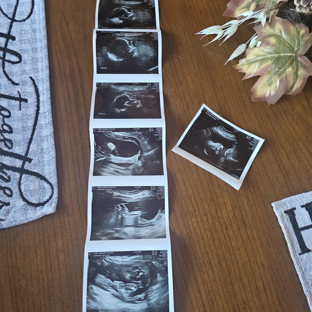 Photo shared by Jordann for their Babylist baby registry.