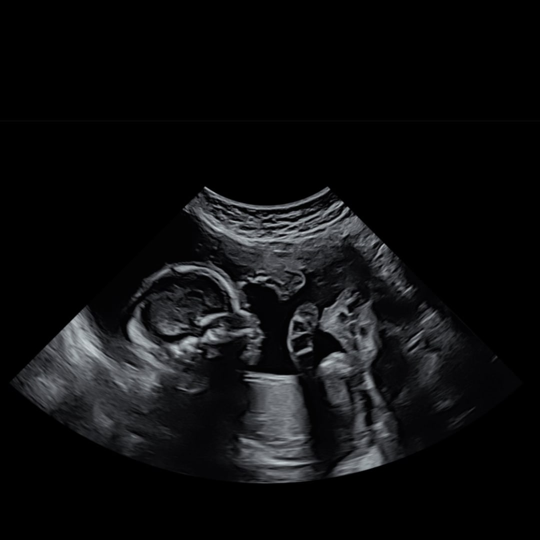 Photo shared by Erika for their Babylist baby registry.