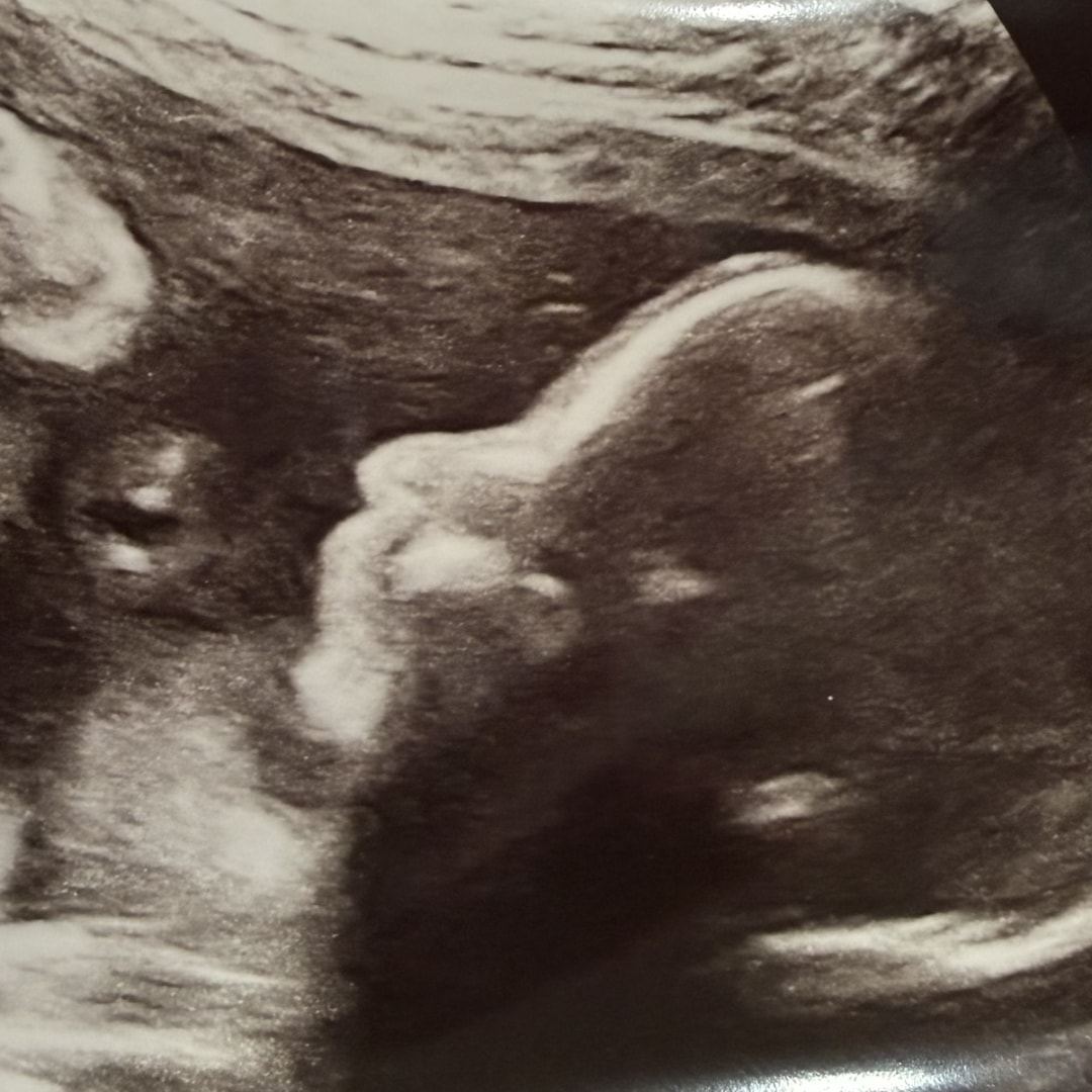 Photo shared by Amanda for their Babylist baby registry.