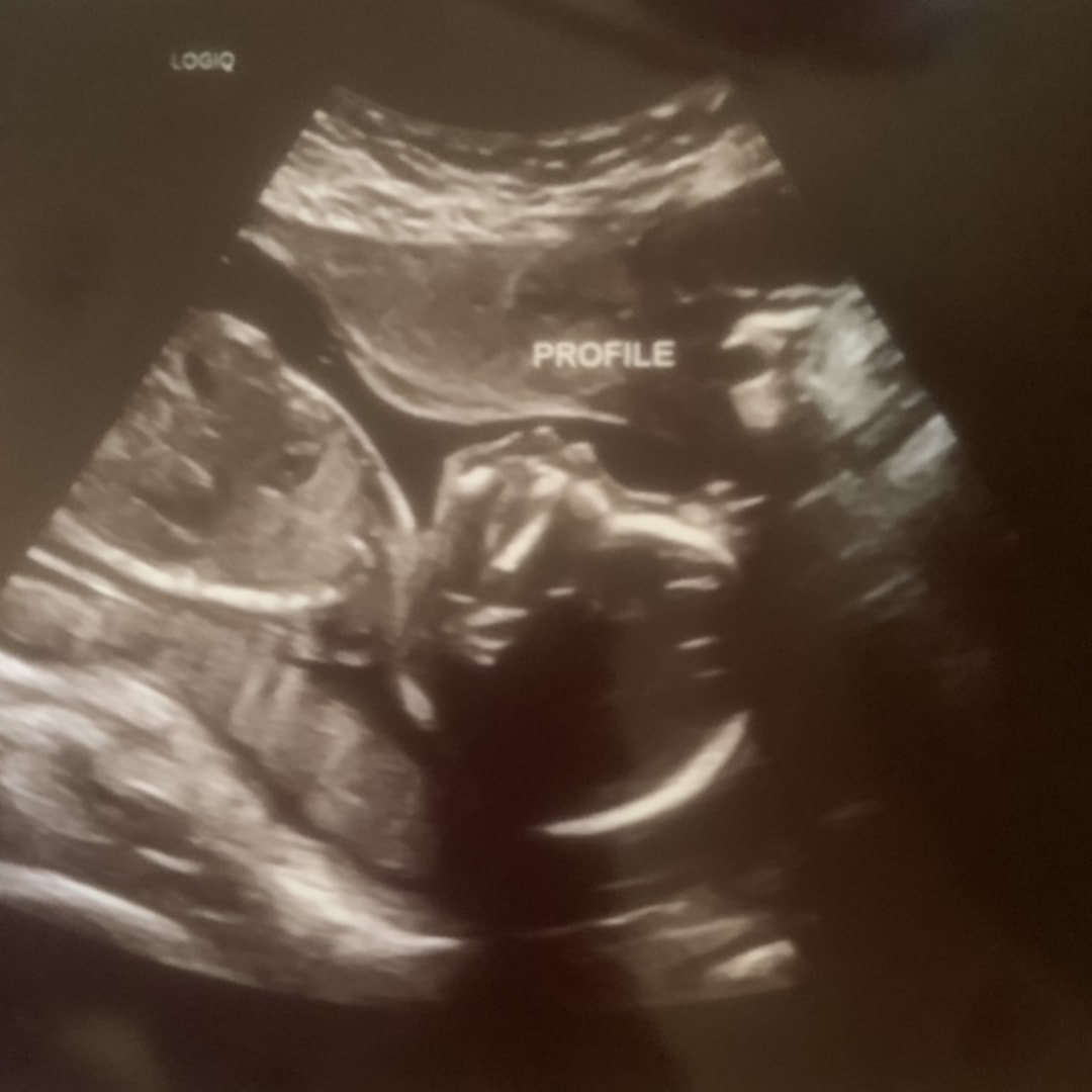 Photo shared by Emily for their Babylist baby registry.