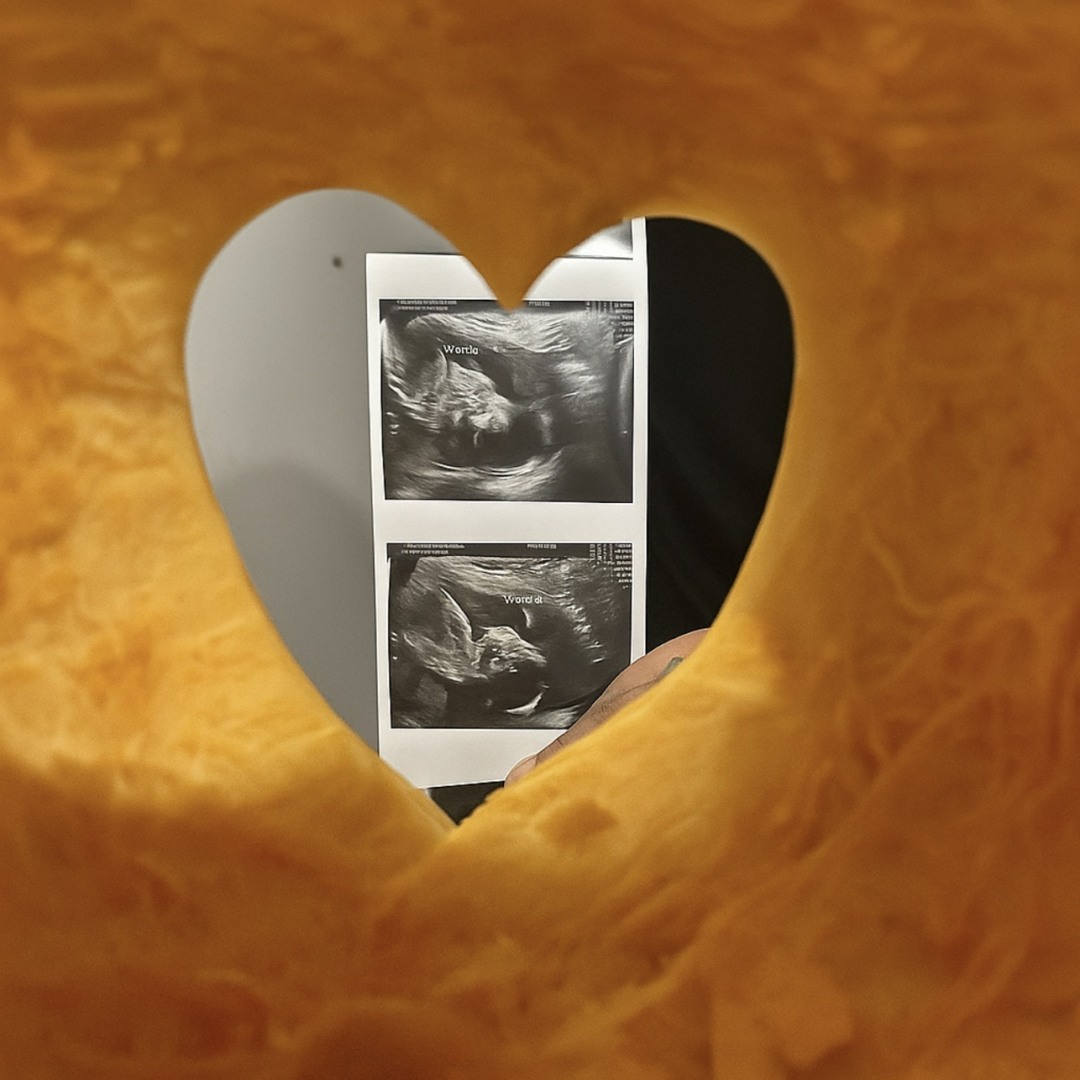 Photo shared by Kaleigh for their Babylist baby registry.