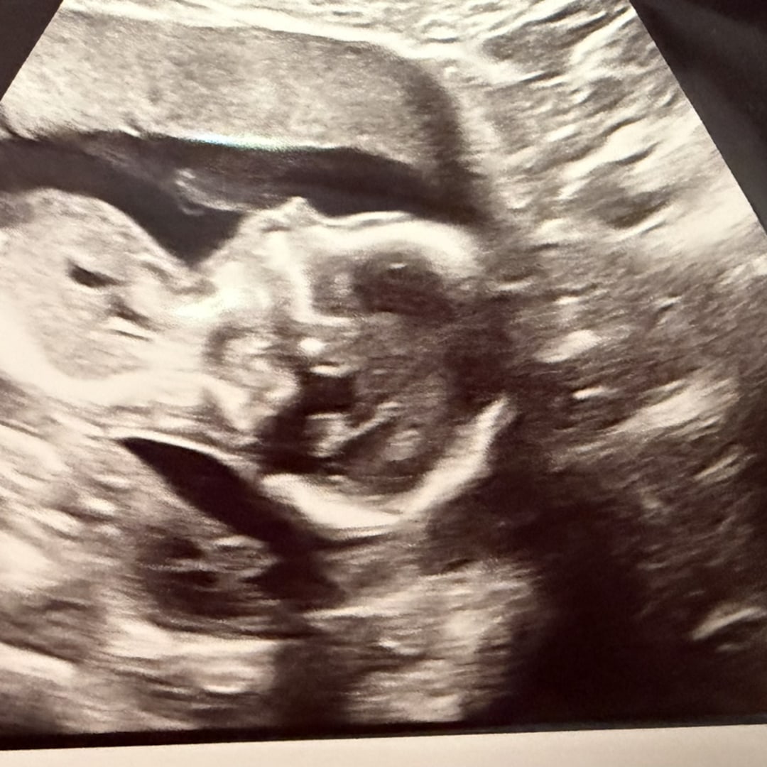 Photo shared by Hannah for their Babylist baby registry.