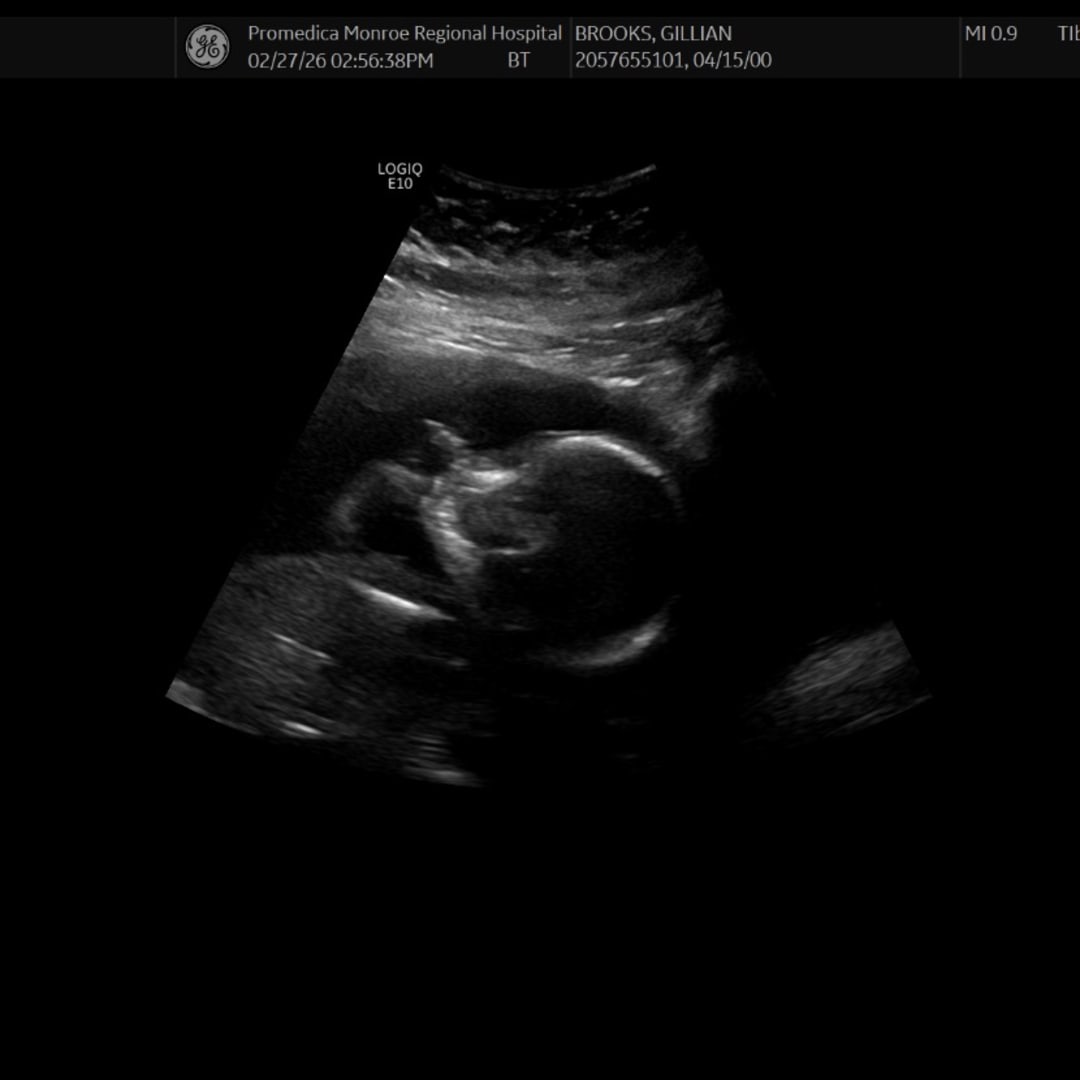 Photo shared by Gillian for their Babylist baby registry.