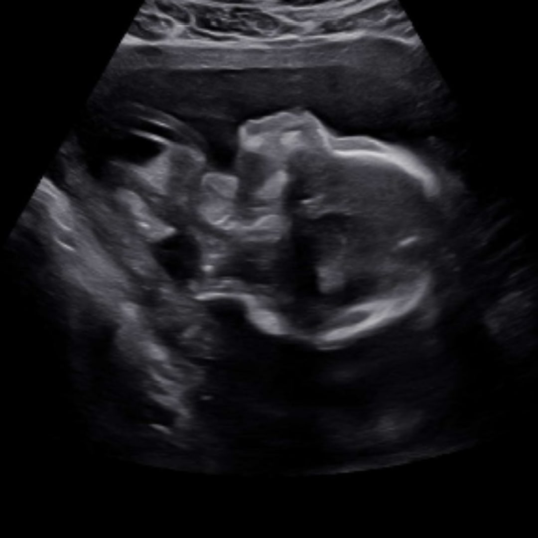 Photo shared by Kaytlyn for their Babylist baby registry.
