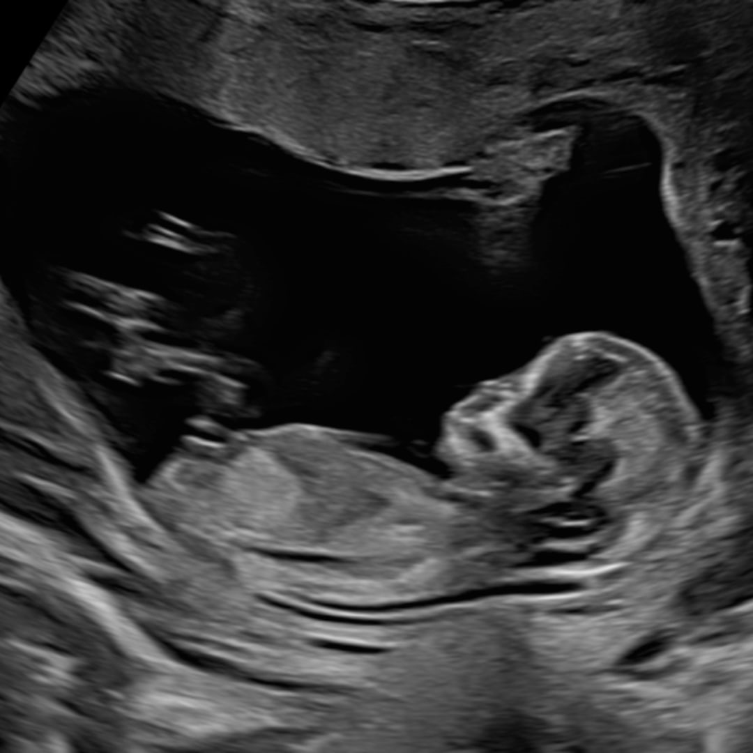 Photo shared by Danica Claire for their Babylist baby registry.