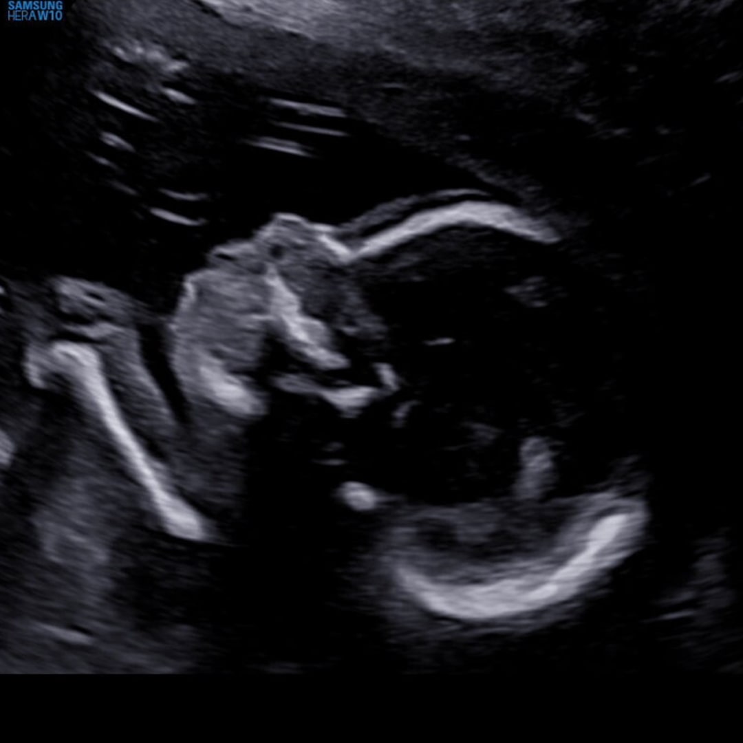 Photo shared by Whitney for their Babylist baby registry.