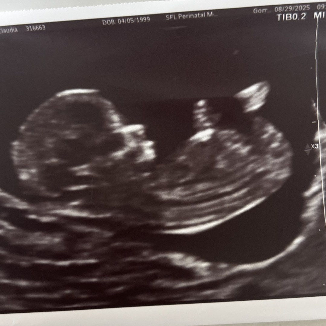 Photo shared by Claudia for their Babylist baby registry.