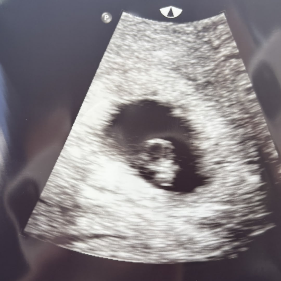 Photo shared by Anna for their Babylist baby registry.