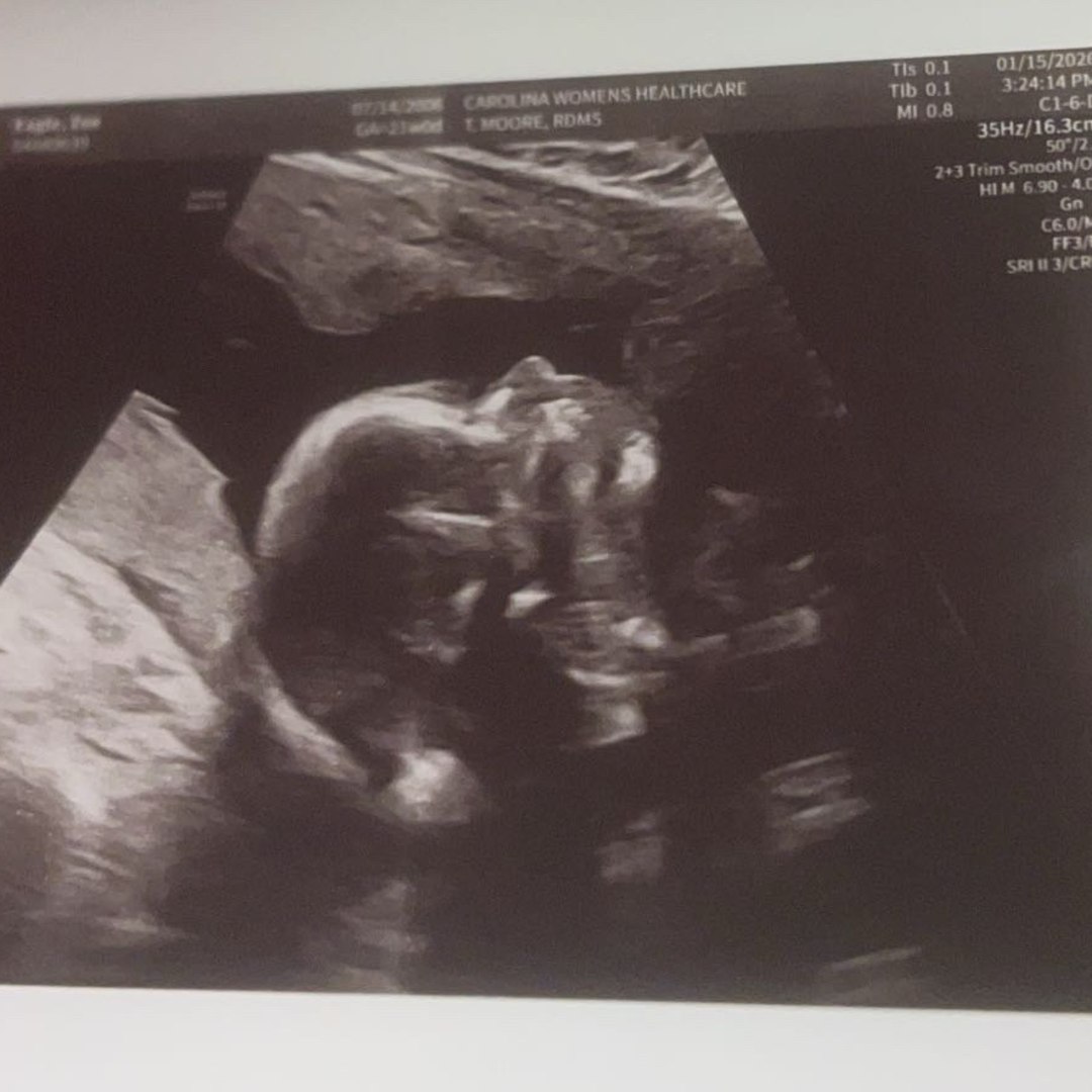 Photo shared by Zoe for their Babylist baby registry.